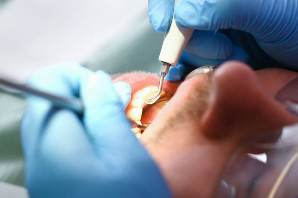 Best Chipped Tooth Repair Near Me  in Jersey Shore, PA