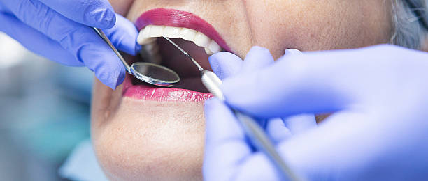 Best Chipped Tooth Repair Near Me  in Jersey Shore, PA